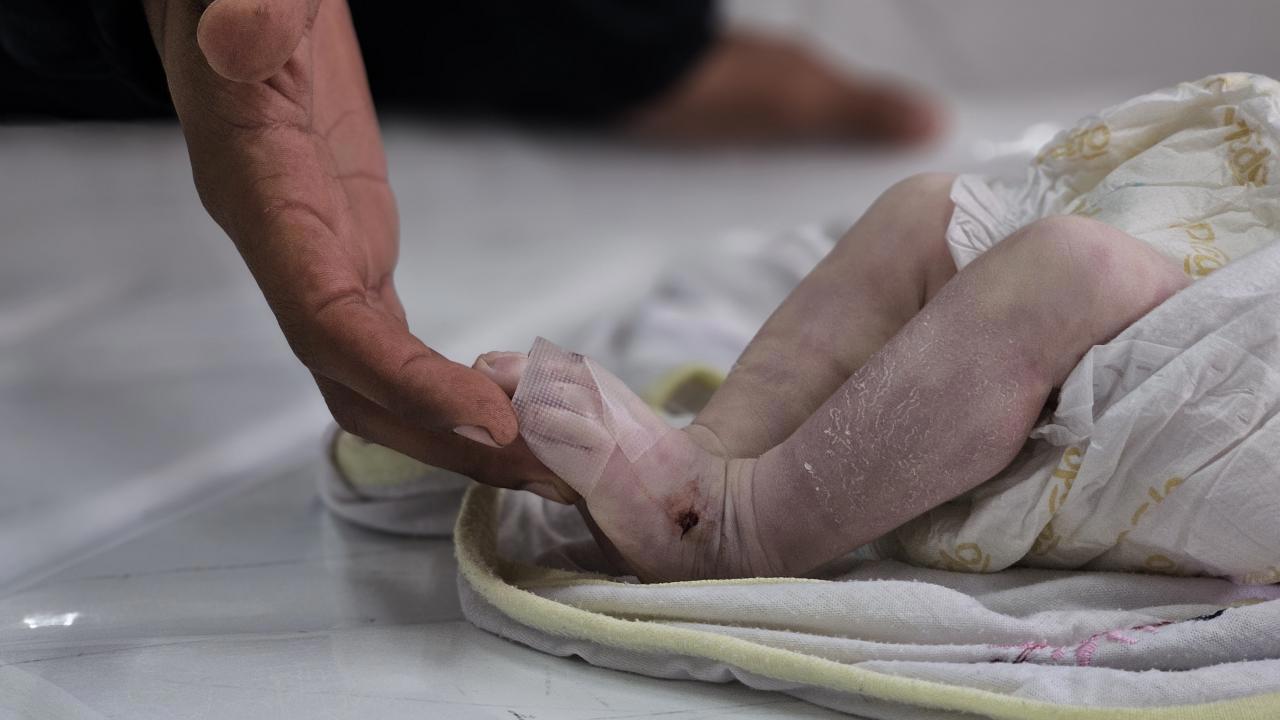 Gazze'de çadırlarda kalan aileler çocuklarının sağlığı için nöbet tutuyor.