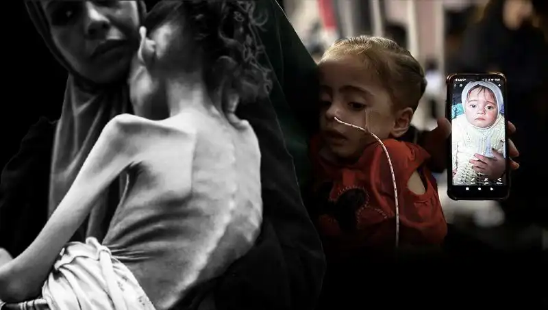 Küçük Meryem'in Dramı: Açlıkla Mücadele Eden 10 Kilo!
