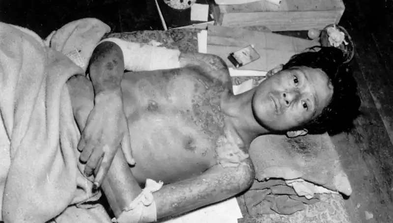 80 Yıl Sonra Nagasaki’den Çarpıcı Uyarı: Nükleer Felaket Tehdit Ediyor