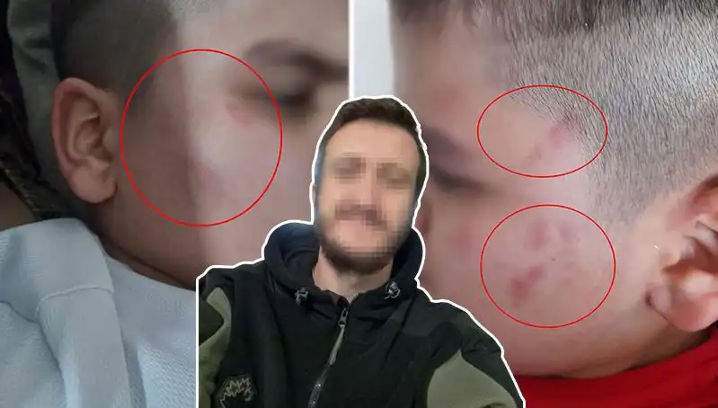 Otizmli Çocuğuna Okulda Dayak Atılan Aile: Skandal Dava Süreci Başladı